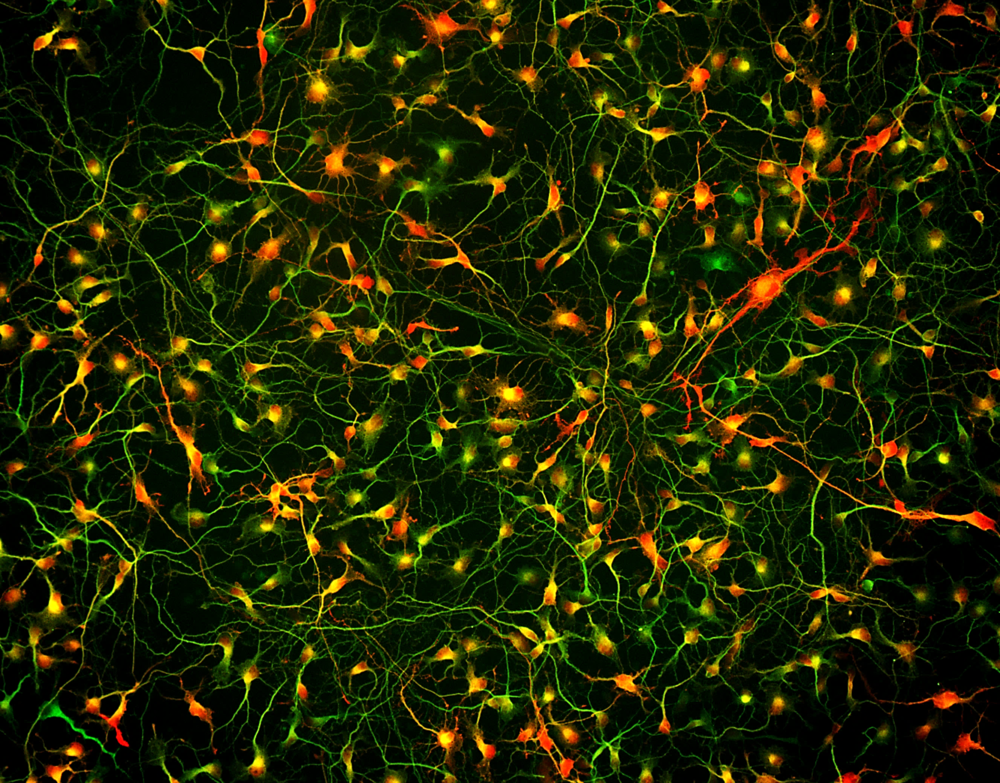 Cortical GABAergic Neurons