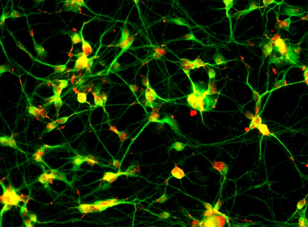 Cortical Glutamatergic Neurons
