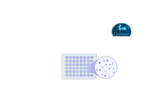 [KT-​1033] ELISA Kits  COVID-19 IgM 
